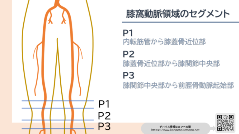 [EVTの対象の血管]今どこ治療してる？この質問を解決したい！ | カンペの獣