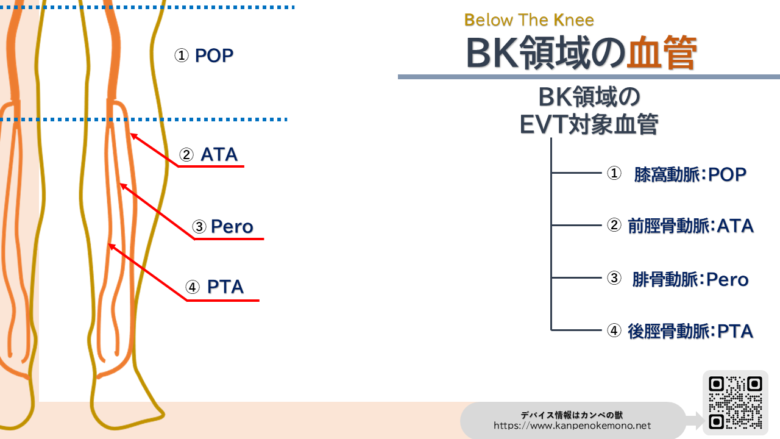 膝窩動脈(POP)・膝下動脈(BK)血管画像
