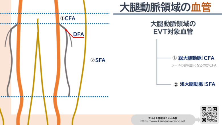大腿動脈領域の血管画像