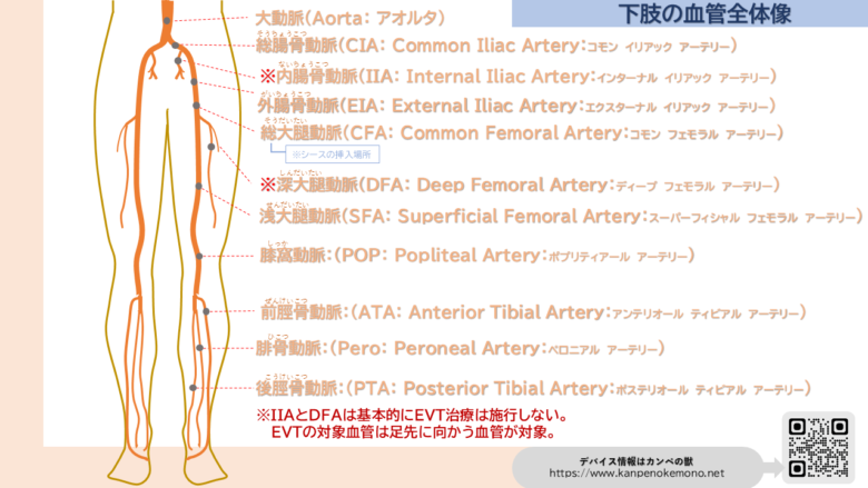 EVT 下肢血管名