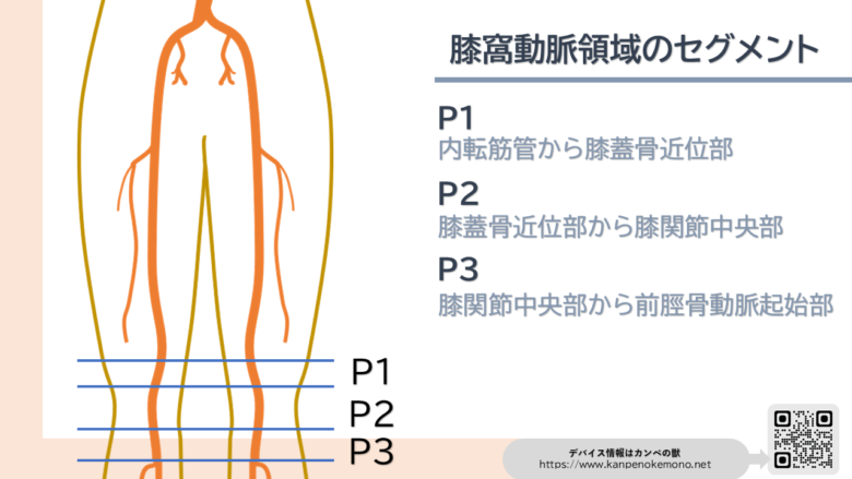 膝窩動脈(POP)領域のセグメント分け P1 P2 P3